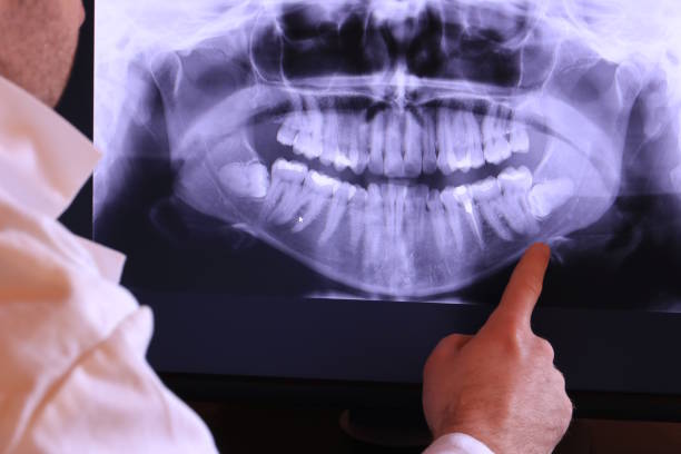 Best Emergency Tooth Extraction  in Perry, LA