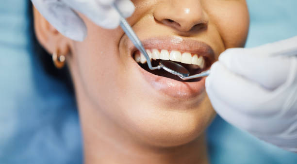 Best Broken Tooth Emergency  in Perry, LA