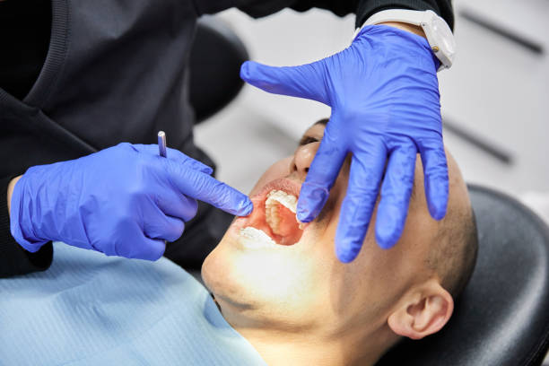 Best Emergency Tooth Extraction  in Perry, LA