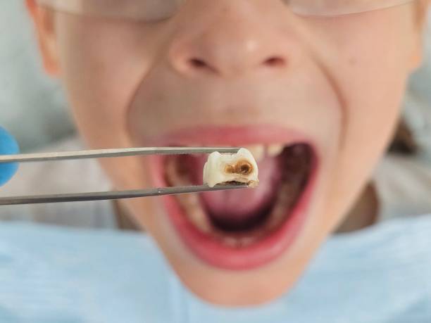 Best Emergency Gum Pain Relief  in Perry, LA